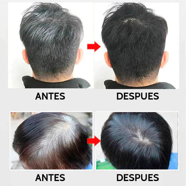 SHAMPOO REVOLUCIONARIO CUBRE CANAS / ENVÍO GRATIS A TODO EL PERÚ